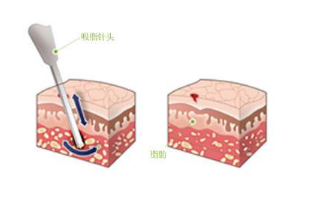 ������֬