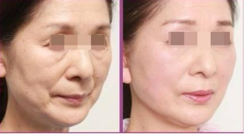 �Ͼ�����ȥ�����ά�ֶ��?