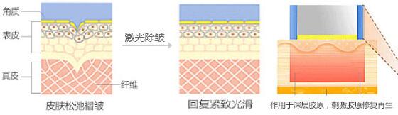 �Ͼ�����ȥ�����ά�ֶ��?