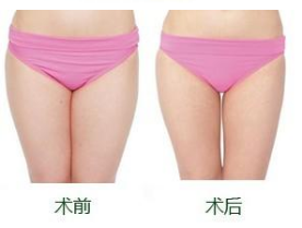 �Ͼ�����μ����β������?