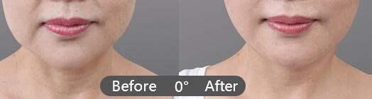 ע��**�������ȥ��������?