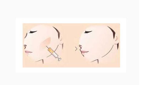 ��ƻ����