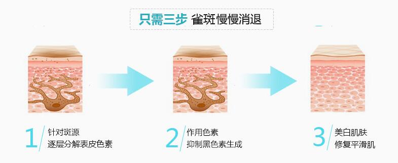 南京做激光祛斑会复发吗?