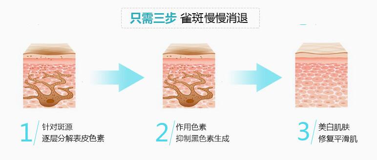 南京做激光祛斑手术会有后遗症吗?