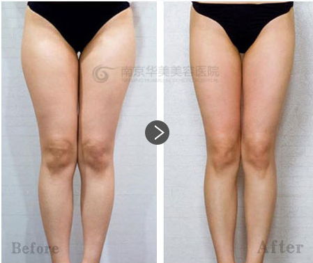 ���Ȳ���֬����Ҫ����������?