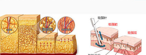 ���ȵķ�������Щ