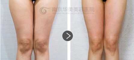 �Ͼ���������֬����Ч�����׷�����